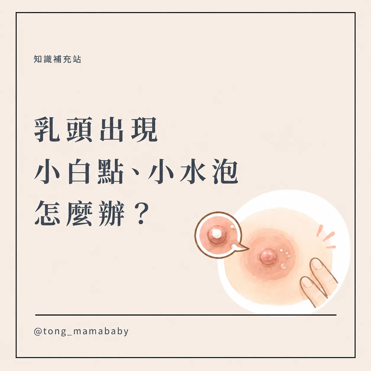 乳頭出現小白點、小水泡怎麼辦?